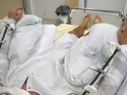 Primer trasplante completo de dos brazos a un hombre en Alemania